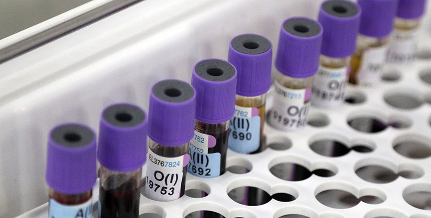 За сутки в Беларуси зарегистрирован 1061 пациент с COVID-19, выписаны 1127 За сутки в Беларуси зарегистрирован 1061 пациент с COVID-19, выписаны 1127